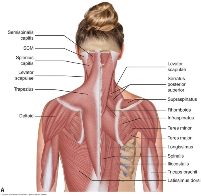 Label the indicated muscles of the head and neck.