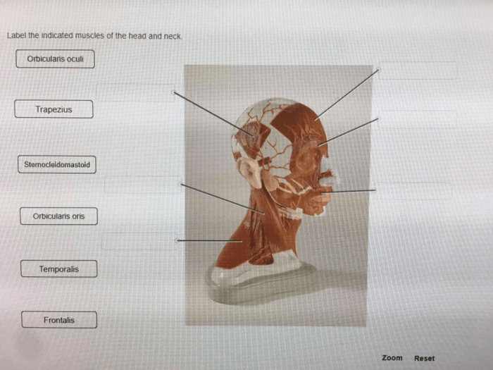 Label the indicated muscles of the head and neck.